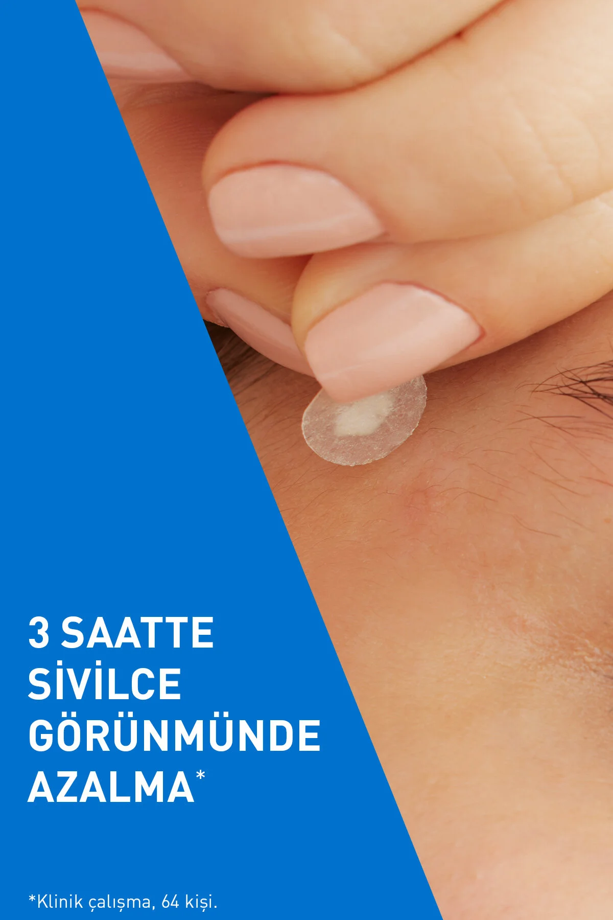 باندهای ضد جوش حاوی اسید سالیسیلیک و سرامید 22 عددی سراوی CeraVe