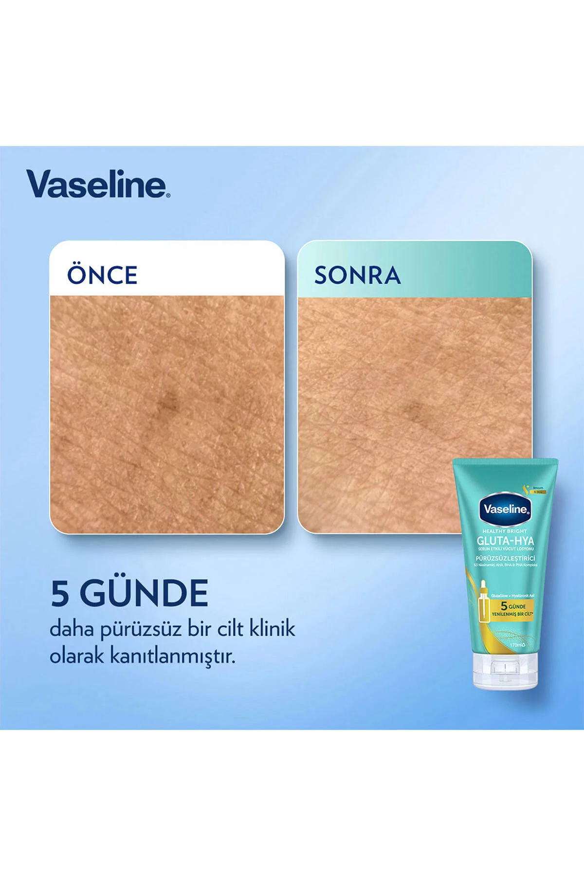 کرم بدن وازلین مدل Gluta-hya حجم 170 میلی لیتر برای نرمی و لطافت پوست Vaseline
