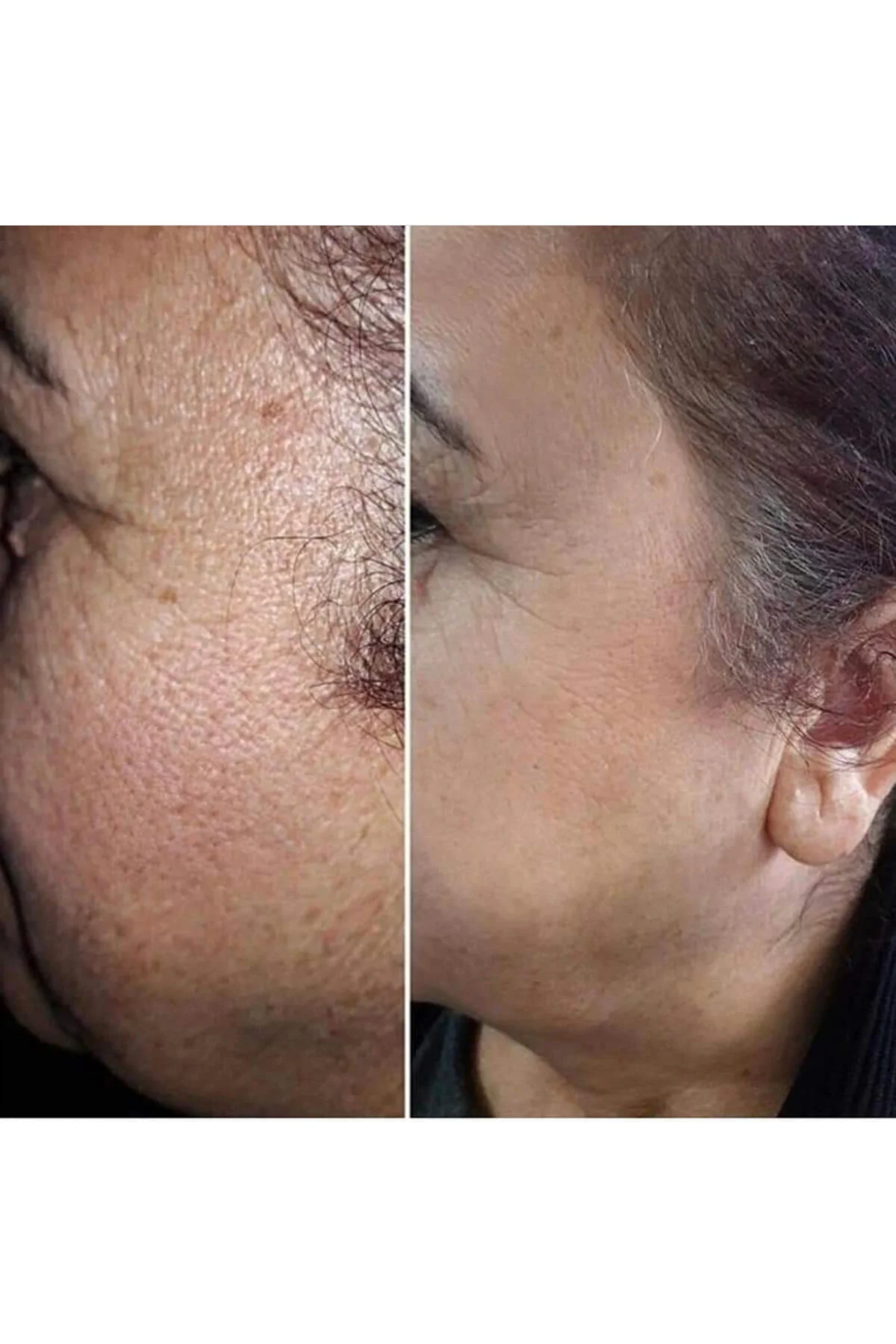 اسکراب صورت 200 میلی لیتری Dermadelete با فرمولاسیون خاص برای پوست Egş DERMA delete