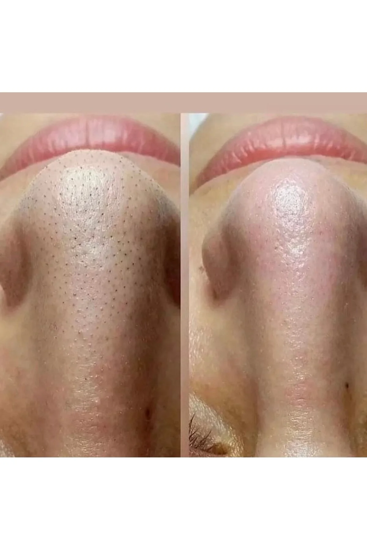 اسکراب صورت 200 میلی لیتری Dermadelete با فرمولاسیون خاص برای پوست Egş DERMA delete