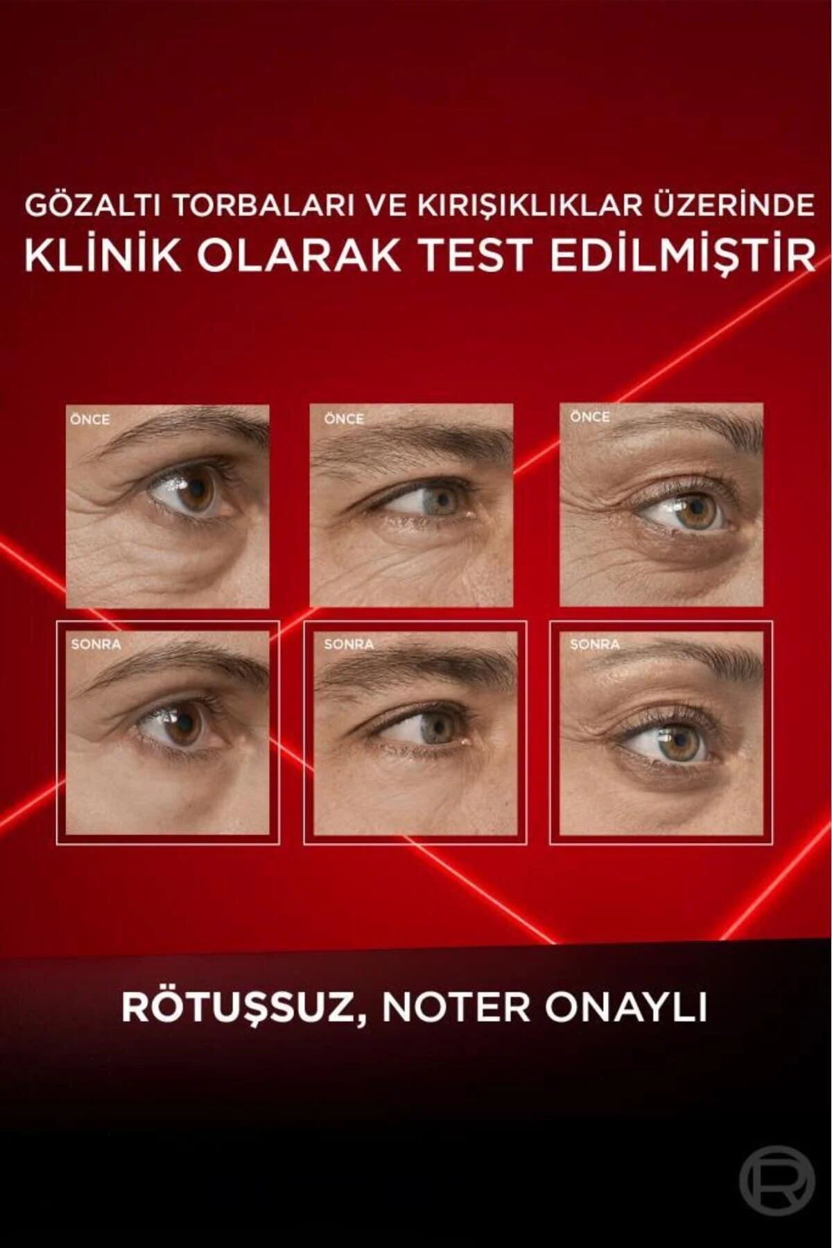 کرم دور چشم لورآل پاریس Revitalift Lazer Eyebag Instant Eraser 15 میلی‌لیتر