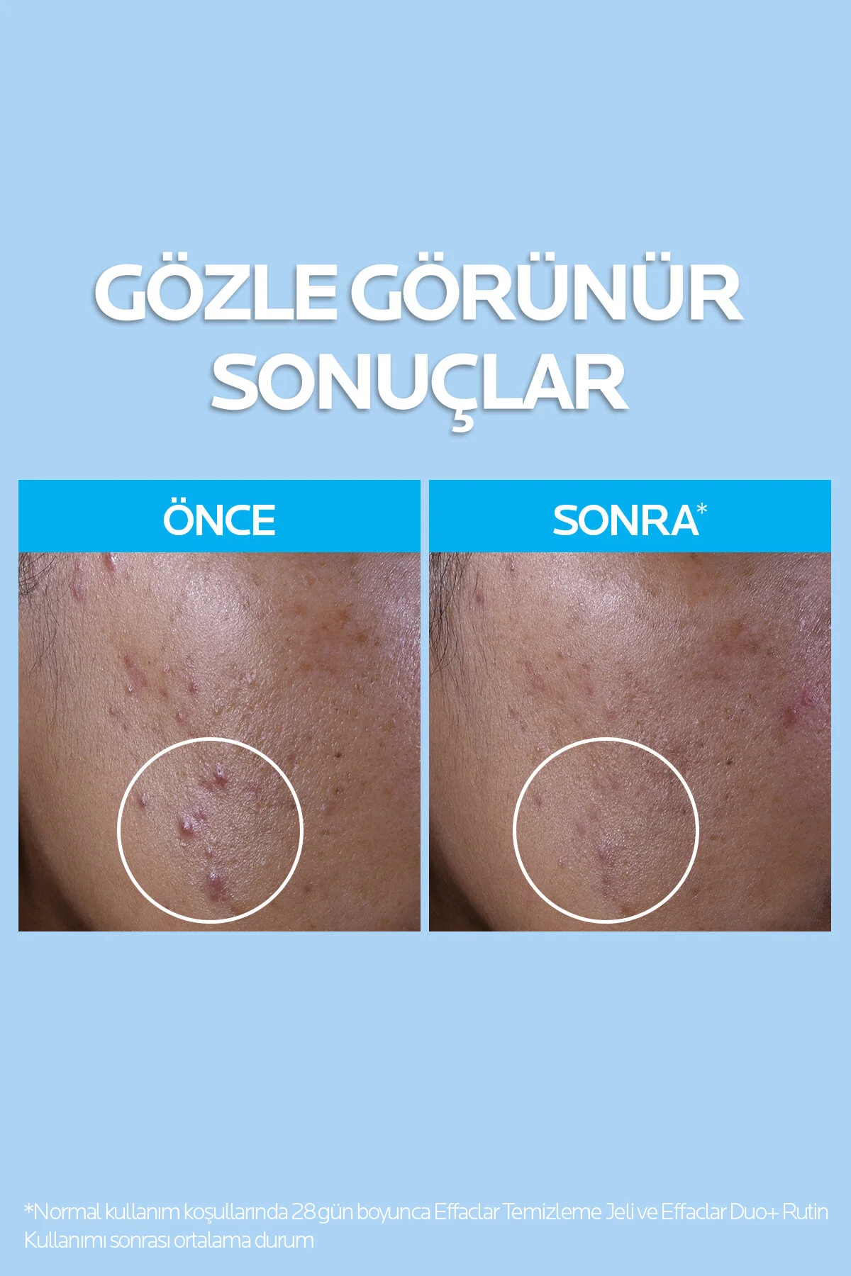 La Roche Posay ژل تمیزکننده صورتی برای پوست جوشی 50 میلیلیترX2 و کرم ضدآفتاب آنتلیوس 50 میلیلیتر