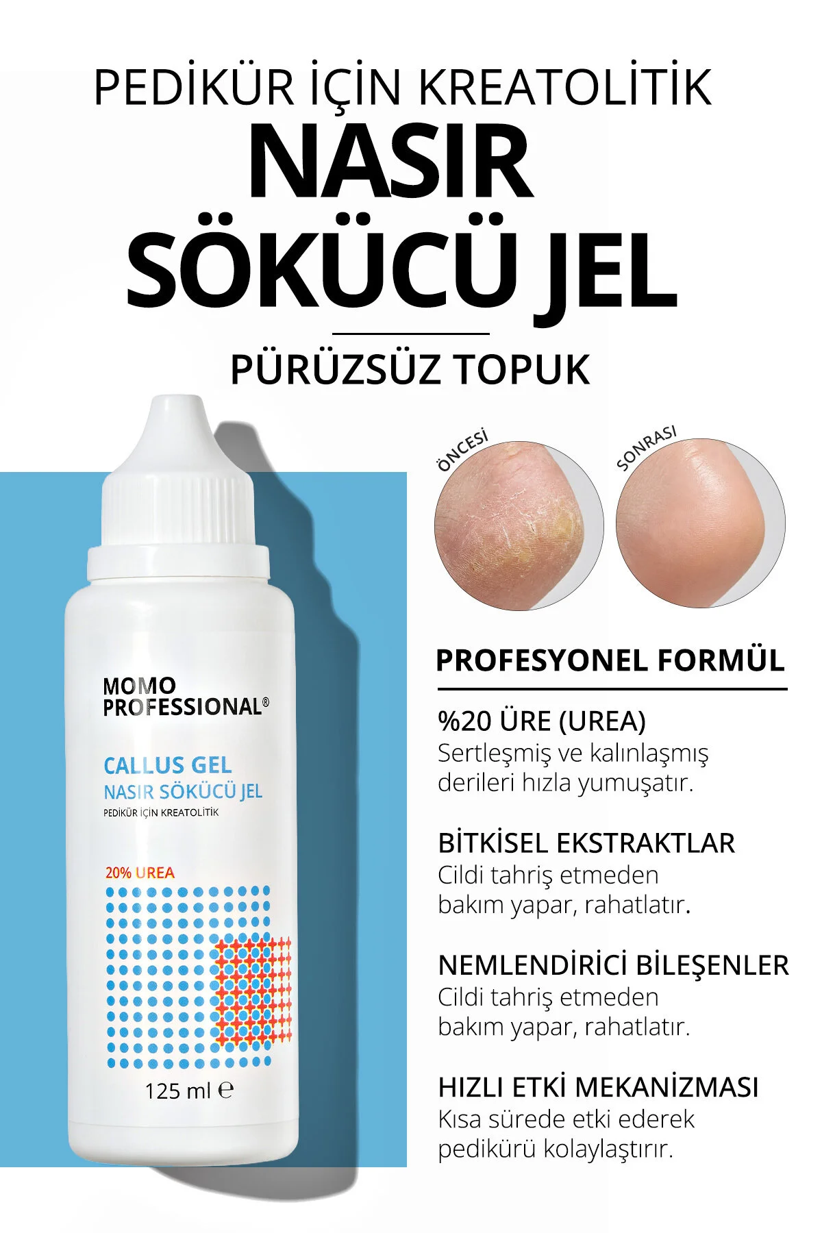 ژل از بین برنده پینه پا مناسب برای پدیکور حجم 125 میلی لیتر MOMO professional