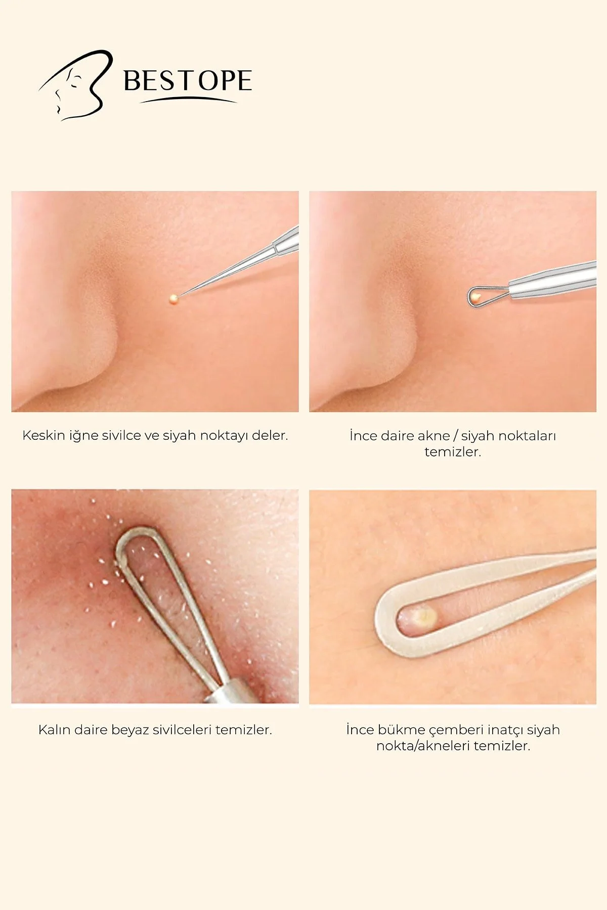 دستگاه مراقبت پوست سیاه 5 I 1 کلاس جراحی دستی کیت تمیز کننده جوش بلندی استیل ضدزنگ  Bestope